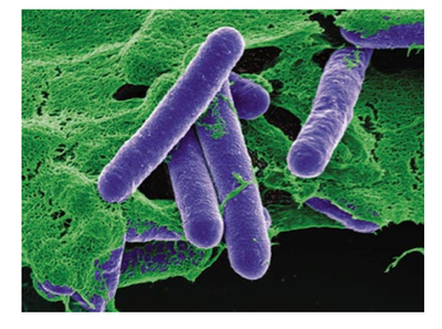 Colorized Scanning Electron Micrograph of Clostridium Botulinum - Micrografía electrónica de barrido coloreada de Clostridium botulinum.